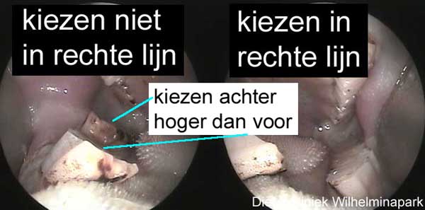 Soms zie je bij cavia's dat de kiezenniet in 1 lijn staan, er zit een zogenaamde stap in de kiezenrij