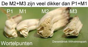 Door een zijdelingse beweging ontstaan te dikke kiezen